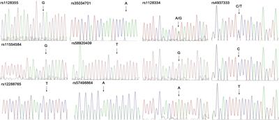 SNP rs4937333 in the miRNA-5003-Binding Site of the ETS1 3′-UTR Decreases ETS1 Expression